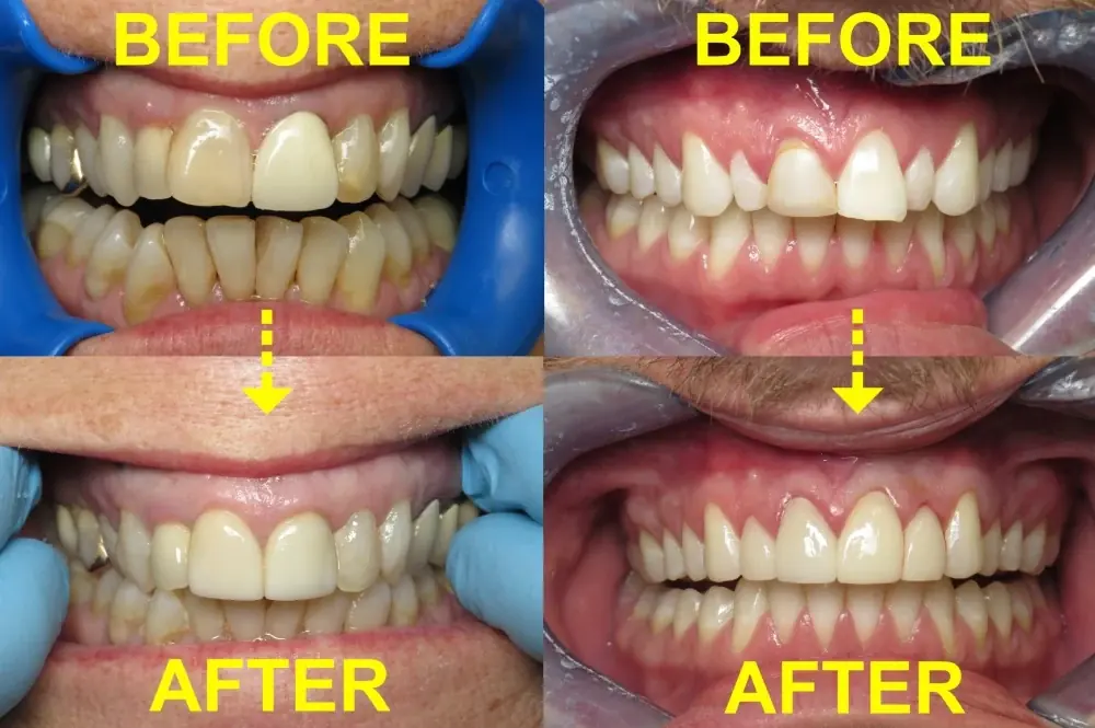 Before and after images of cosmetic reconstruction work carried out at the practice.